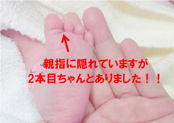 近藤千尋の子供 長女 は足の指4本 スクールはどこ 名前や顔写真も アスワカ