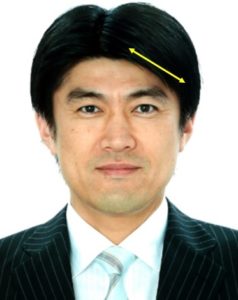 画像 藤井貴彦の髪はかつら 若い頃から剛毛で地毛に見えないだけ アスワカ