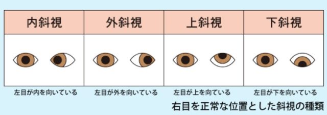 画像 ニューヨーク嶋佐和也は目が斜視で離れ過ぎ 目が好きという声も アスワカ